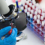 Close-up of microscope lens focused on a blood sample for genetic research.